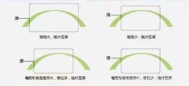 孩子配镜的时候如何选择镜片