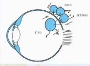 近视眼轴增长引起眼底病变