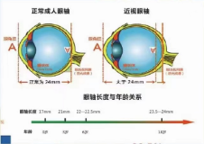 眼轴的发育规律