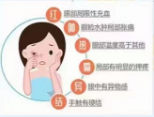 哪些原因可能导致眼睛红肿?