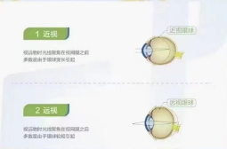 远视就可以看的更远吗?