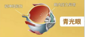 为什么不能关灯玩手机
